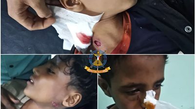 إصابة ثلاثة أطفال في منطقة حجر شمال الضالع جراء انفجار بقايا مقذوف حوثي